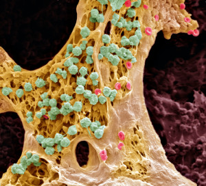 Bone marrow, SEM